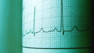 call retry frequency monitoring